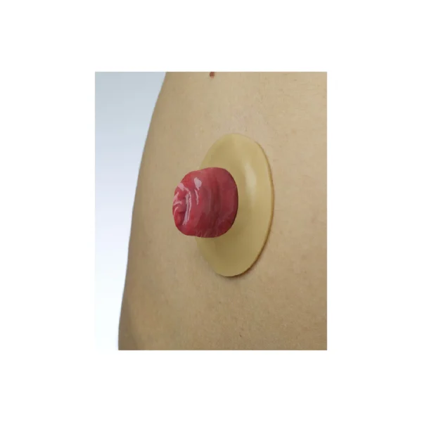 Coloplast 12030 Brava Mouldable Ring 2mm