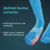 bunion splint