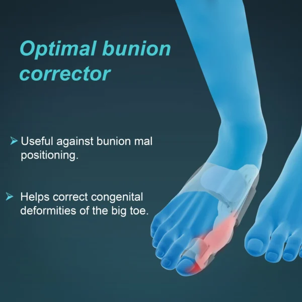 bunion splint